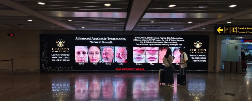 Iklan kesehatan Cocoon Medical Spa di layar LED Bandara Internasional I Gusti Ngurah Rai Bali dengan tagline Welcome to Bali Ready to Glow.